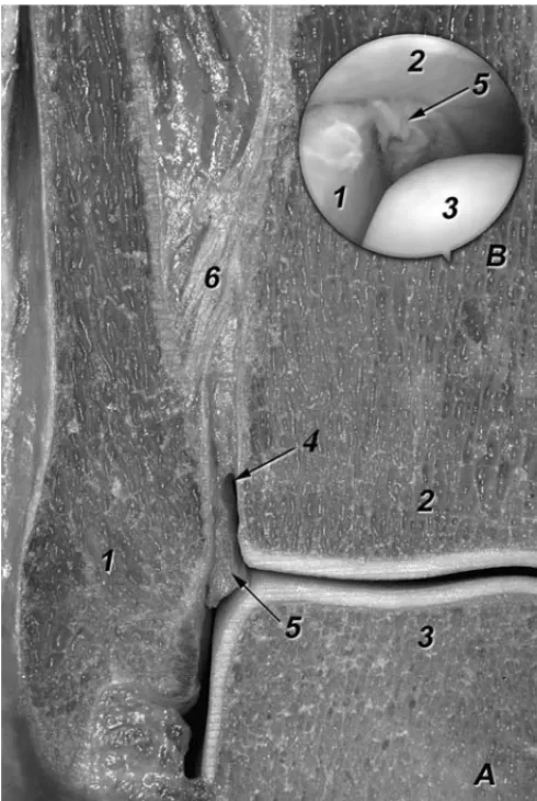 Figura 1. Corte frontal a nivel de la articulación del tobillo derecha (A). 1. Peróne