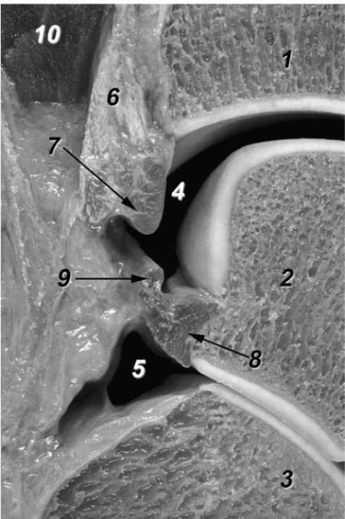 Figura 5. Detalle de la región posterior de las articulaciones talocru- talocru-ral y subtalar a través de un corte sagital