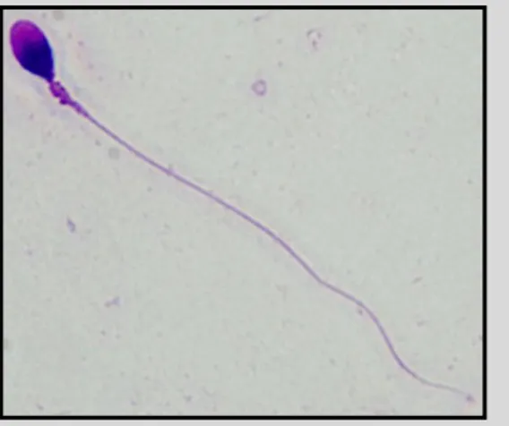 Figura  2.3.  Imatge  de  microscopia  òptica  1000x  d’un  espermatozoide  sotmès  a  la  tinció  Diff-Quik® 