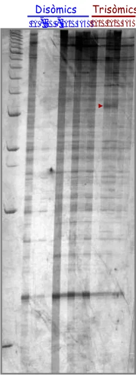 Figura 2. Imatge d'un gel de DD-PCR fent servir la parella T7/P7. A la part 