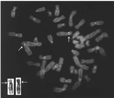 Fig. 2.  Multiple-tissue northern blot analysis of PDCD9. The 1-kb PDCD9 PCR product was used as a probe, revealing a ubiquitously expressed 1.5-kb mRNA species