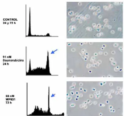 Figura R7. Determinación de la actividad SA-E-galactosidasa lisosomal a pH 6.0 en células Jurkat  tratadas con 91 nM Daunorubicina, 60 nM WP631 o sin tratar