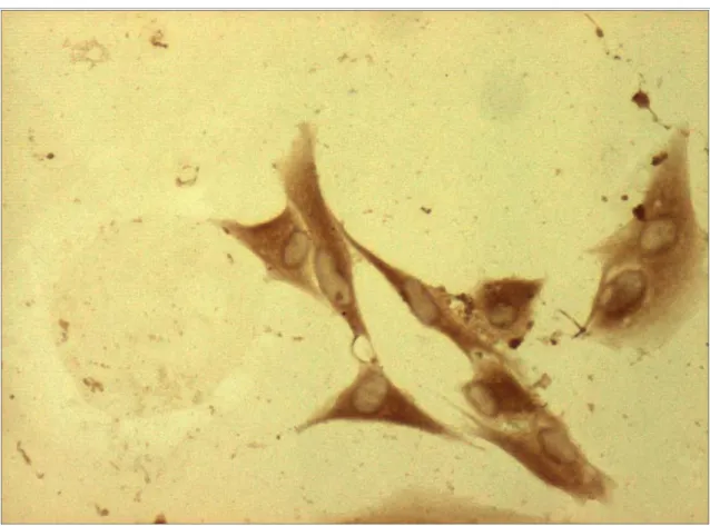 Figura 6. Células osteoblásticas humanas con tinción citoplasmática positiva, expresando 