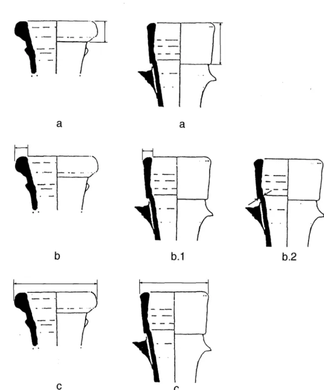 FIGURA 3:  Medidas tomadas a las ánforas:  a) Altura del labio. b) Anchura del labio (para la forma DresseI2-4)