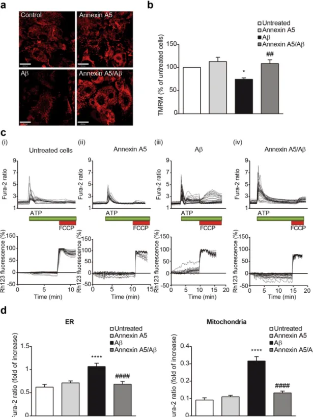 Figure 6.  Annexin A5 restores mitochondrial depolarisation in Aβ-treated choroid plexus cultures in a Ca 2+ -
