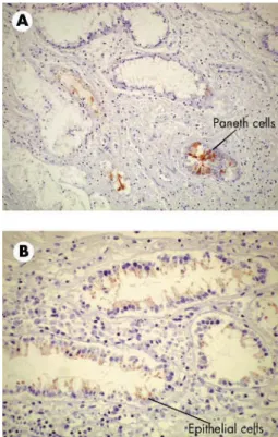 Figure 4 Reduction of cytokine secretion from mucosa samples incubated with pancreatitis associated protein (PAP)