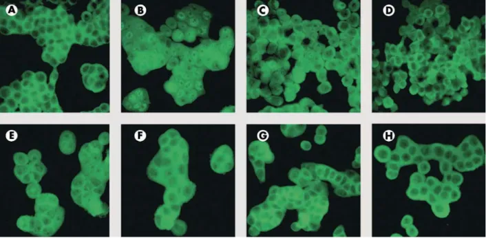 Figure 6 Effect of pancreatitis associated protein (PAP) on nuclear translocation of nuclear factor kB (NFkB) in colonic epithelial cells