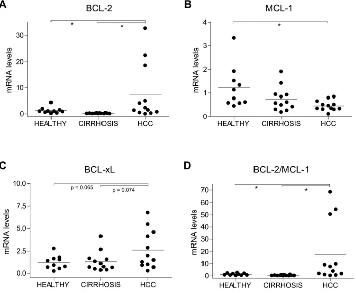 Figure 3: Alterations in BCL-2, MCL-1 and BCL-xL mRNA levels in HCC patients.  (A) BCL-2, (B) MCL-1, (C) BCL- BCL-xL and (D) BCL-2/MCL-1 mRNA levels were measured by qPCR in healthy liver (n=10) and in cirrhotic and tumoral tissue from HCC  patients (n=12)