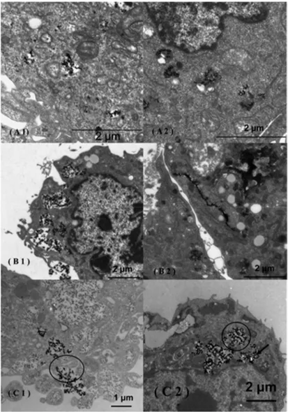 Figure 1. Transmission electron microscopy (TEM) images of MCF-7 (A1,A2),   3T3 (B1,B2) and Caco-2 (C1,C2) cells incubated in the presence of uncoated   super-paramagnetic iron oxide NPs (SPIONs)
