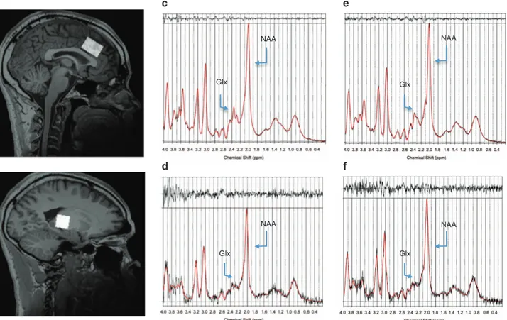 Figure 1. Spectroscopic voxel placement in the anterior cingulate (AC) cortex (a) and in the left thalamus (LT; b)