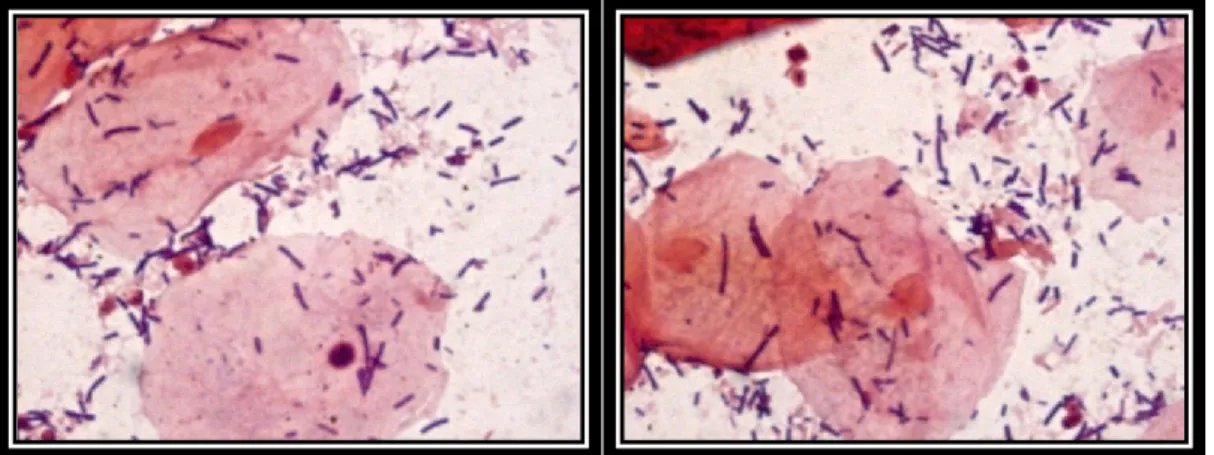 Figure 9-2. Vaginal smears examined under the microscope after Gram staining. 