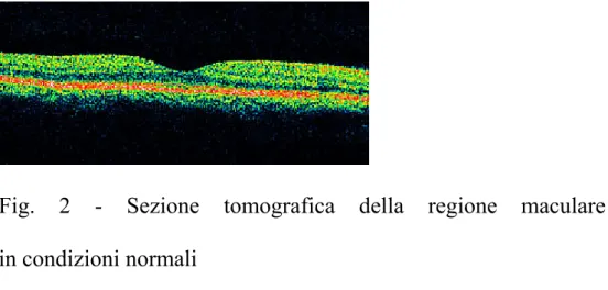 Fig. 2 - Sezione tomografica della regione maculare  in condizioni normali 