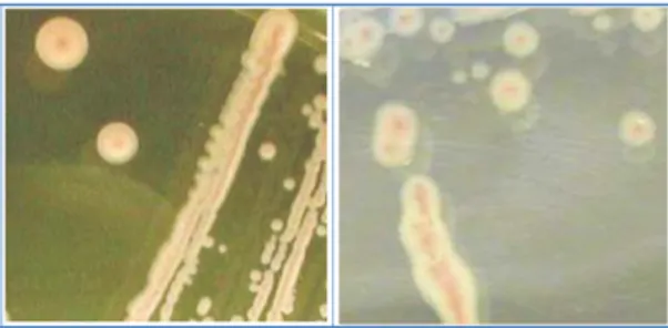 Figura  10  Colonie  di  Bifidobacterium  spp.  su  BSM  agar  come  indicate  dal  fornitore