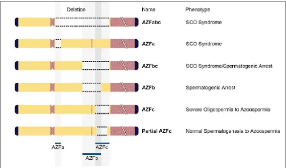 Fig. 5 Delezioni della regione AZF. Correlazioni Genotipo-Fenotipo La  prevalenza  delle  microdelezioni  dell’Yq  nei  soggetti  infertili  è stimata  attorno  al  10%  (Foresta  et  al.,  2001)