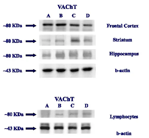 Figure 7: Western blot of brain area and Blood lymphocytes of rats: WKY Control (A); SHR Control (B); SHR treated 
