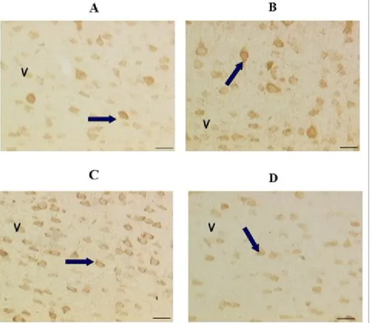 Figure  9:  VAChT immunohistochemistry  in  Frontal  Cortex of rat  brain: WKY Control (A);  SHR Control (B); SHR 
