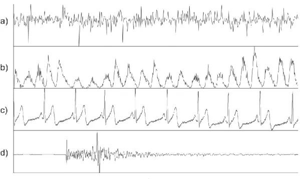 Fig.  1.2.  Examples  of  time  series  data  relative  to  a)  monsoon,  b)  sunspots,  c)  ECG  (ElectroCardioGram), d) seismic signal