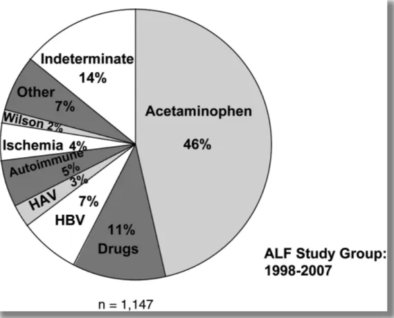 Figure 16: Etiology of acute liver failure in adults in the U.S. 