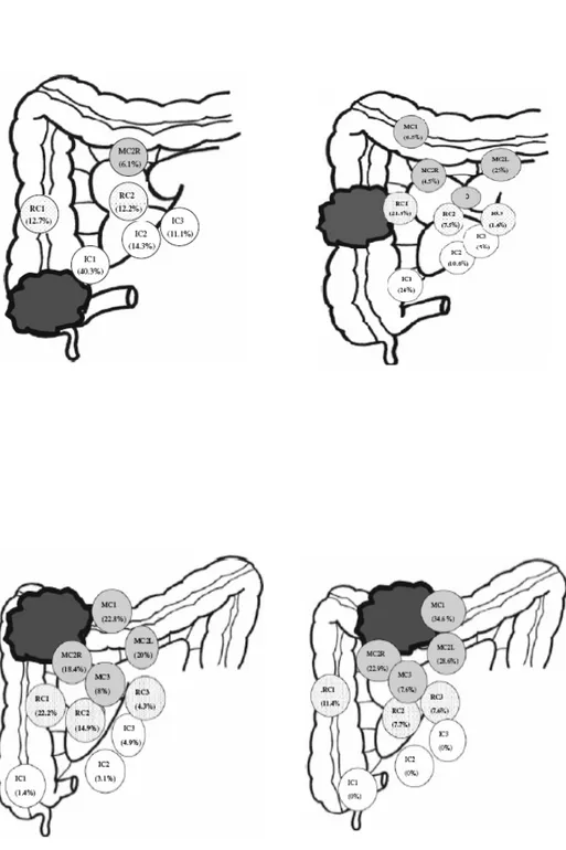 Fig. 5:  Diagramma dello spreading dei tumori del colon destro e del trasverso prossimale