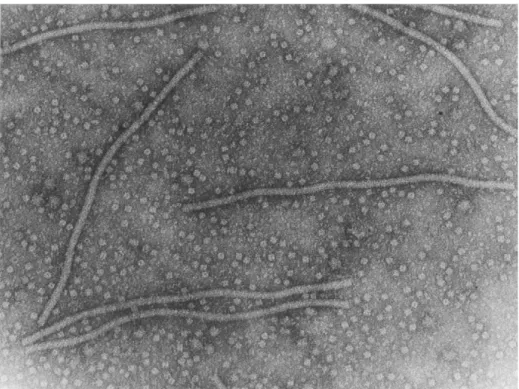 Fig. 10 – Virus del mosaico del Pepino osservato al microscopio                    elettronico
