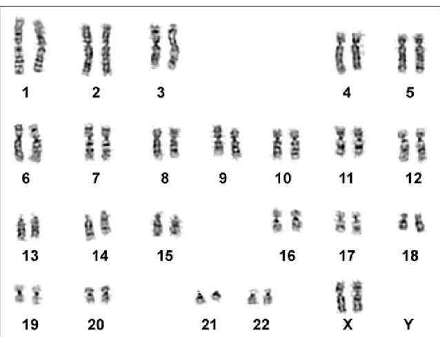 Fig. 38: Cariotipo con bandeggio G del cariotipo con l’inversione pericentrica del cromosoma 9