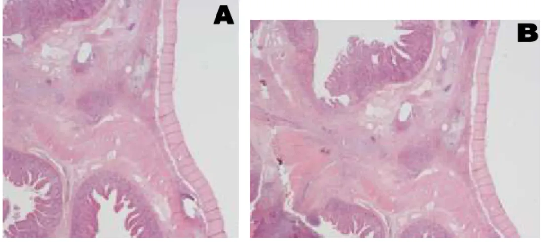 Figura  8:  Sezione  a  tutto  spessore  della  parete  intestinale  in  corrispondenza  dell‟anastomosi  rivestita  dalla  protesi  nel  gruppo  con  perforazione  (Gruppo  4)