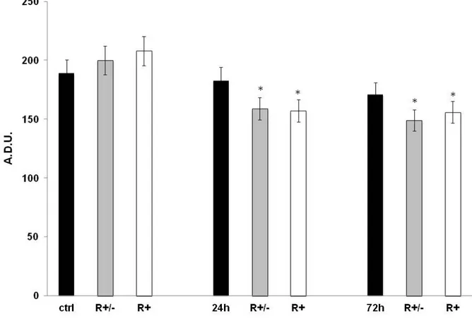 Figure 15. Immunoblotting analysis for AIF, performed on untreated HA and HA treated with  MeHg 1.125 µM in combination with Lipoic Acid (R± or R+) either for 24 hr or for 72 hr