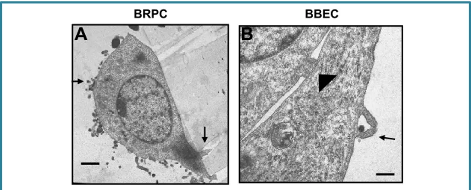 Fig.  6.  Transmission  electron  micrographs  of  BRPC  (A)  and  BBEC  (B–D)  infected with E