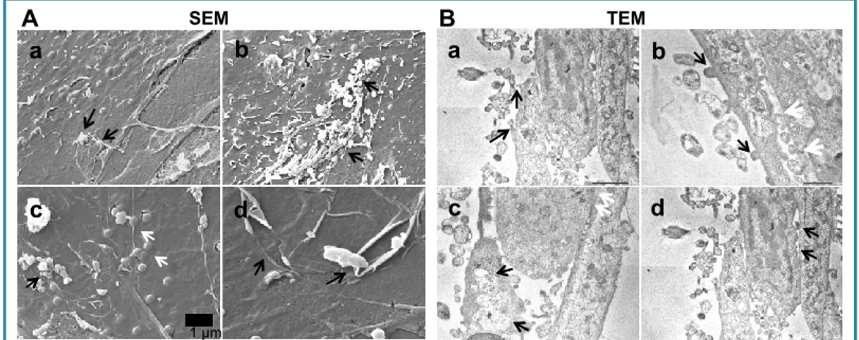 Figure  11. A. SEM  images of hBMECs grown on Transwell membrane 6h after Hia infection