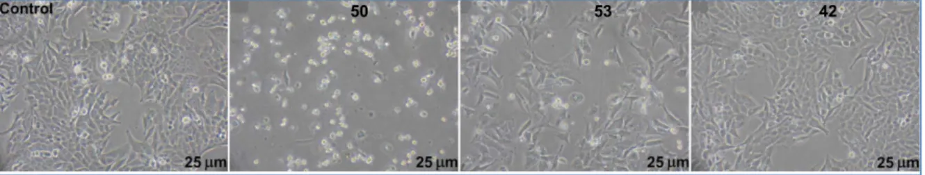 Figure 5: Phase contrast microscopy observation of SW480 colon cancer cells treated or not 