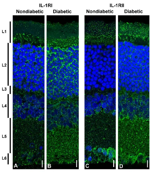 Figure  6  -  Distribution  of  IL-1RI  and  IL-1RII  in the  normal  and  diabetic rat  retina  