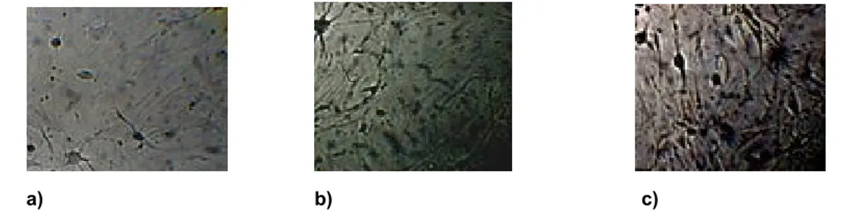 Fig.  4.  Expression  of  neural-like  cells  specific  markers  in    differentiated  CB-MSCs  evaluated  by  immunostaining for a)  GFAP, b) nestin c) Neurofilaments, respectively