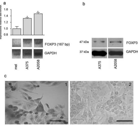 Fig.  7  a:  Analisi  semiquantitativa  tramite  RT-PCR  dell’espressione 