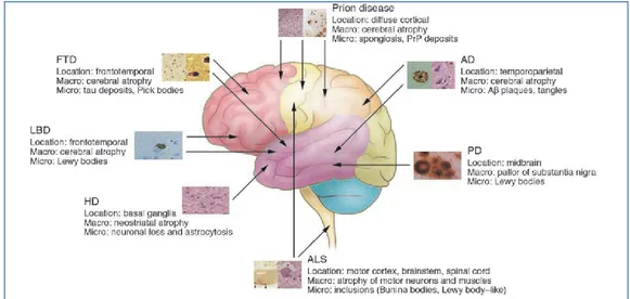 Figura 3. Schema della posizione anatomica e dei cambiamenti macroscopici e  microscopici caratteristici delle malattie neurodegenerative (Bertram L., Tanzi R.E.,  2005)