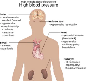 Figura 2: Possibili complicanze dell’ipertensione  1.1.4 Sintomatologia 