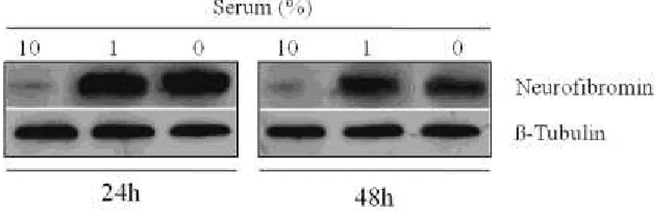 Figure  3  -  Western  blot  analysis  of  neurofibromin  in  MPNST  cells 