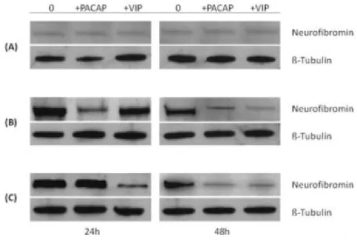 Figure 5 - Western blot analysis of neurofibromin in 100nM PACAP- or 