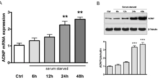 Figure  1  -  Time-dependent  effect  of  serum  starvation  on  ADNP  expression in MPNST cells