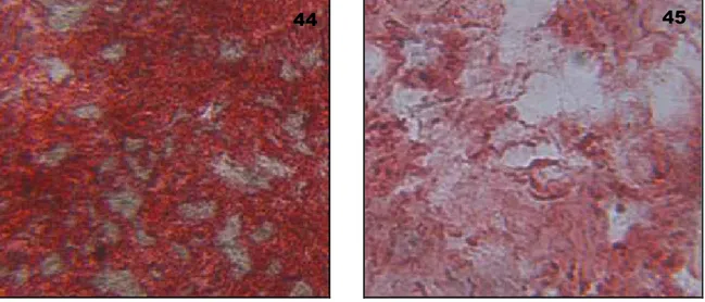 Graphic  V  –  Alizarin  red  staining  measurement  in  hBMSCs  on  extracellular  matrix  coating  and  plastic 