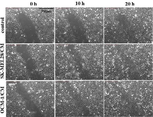 Fig. 11 Effetto del medium condizionato di SK-MEL28 ed OCM-1 sulla capacità delle 