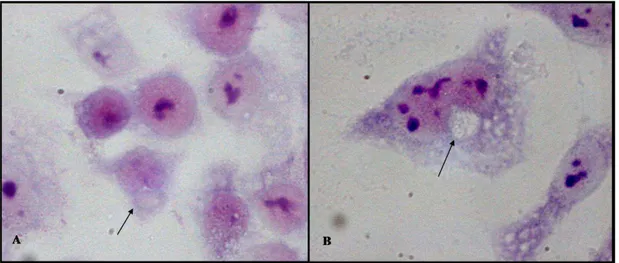 Figura  5  Tipiche  inclusioni  clamidiali  ottenute  infettando  cellule  HEp2  con  i  ceppi  CM-1  (A)  e  TWAR  CDC/CWL-029  (B),  colorate  con  Giemsa  e  osservate  al  microscopio ottico a 40X (A) e 100X (B)