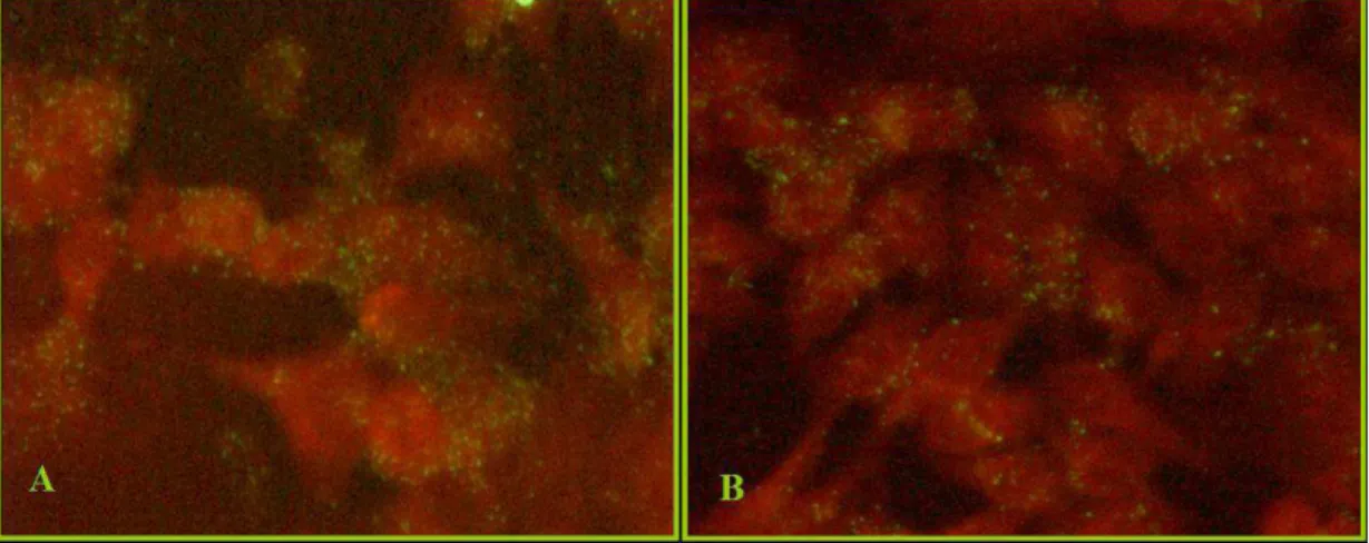 Figura  6  Tipiche  inclusioni  clamidiali  ottenute  infettando  cellule  HEp2  con  i  ceppi  TWAR CDC/CWL-029 (A) e CM-1 (B), e osservate al microscopio a fluorescenza a  40X