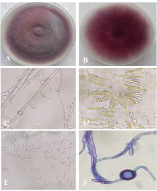 Figure  ‎ 2.12  Morphological  characteristics  of  F.  oxysporum.  A,  colony  morphology  from  the  front  side;  B,  reverse  side;  C,  short  conidiophore;  E,  macroconidia;  F,  microconidia and F, chlamydospores