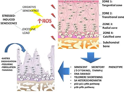 Figure 5. Stress-induced senescence and Osteoarthritis. The telomere shortening process in senescent chondrocytes is 