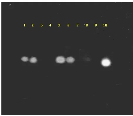 Fig.  13.   Agarose gel of cDNA from Neuroblastoma cells. -  1: Untreated; 2: 10  µM unmodified ODNs+25 µM CoCl 2 ; 3: 20 µM unmodified ODNs+25  µM  CoCl 2 ;  4:  30  µM  unmodified  ODNs+25  µM  CoCl 2 ;  5:  5  µM  of  2 +25 µM CoCl 2 ; 6: 5 µM of  1 +25