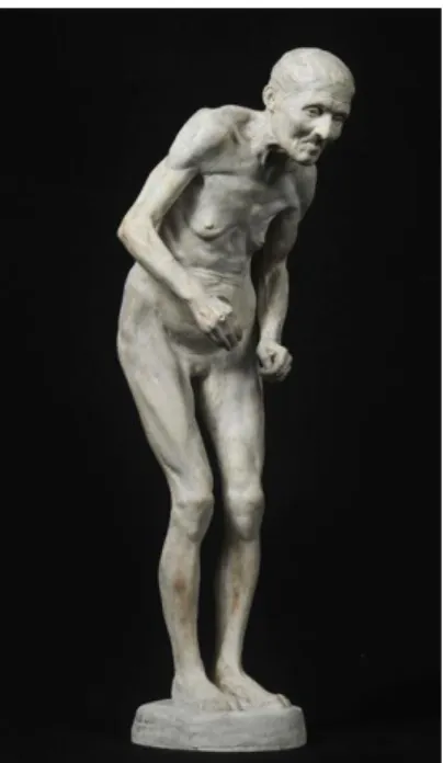 Fig. 5 – Paul Richer, Statuetta della Maladie de Parkinson, 1895, gesso, 47 x 16 x 16 cm), ENSBA, Parigi.