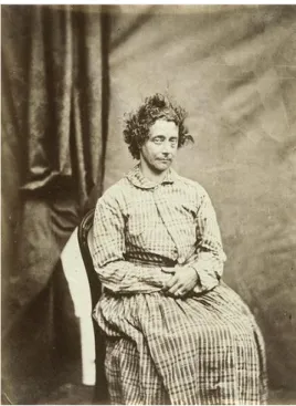 Fig. 6 – Paziente del Surrey Asylum, Calotipo, H.W. Diamond, 1852 
