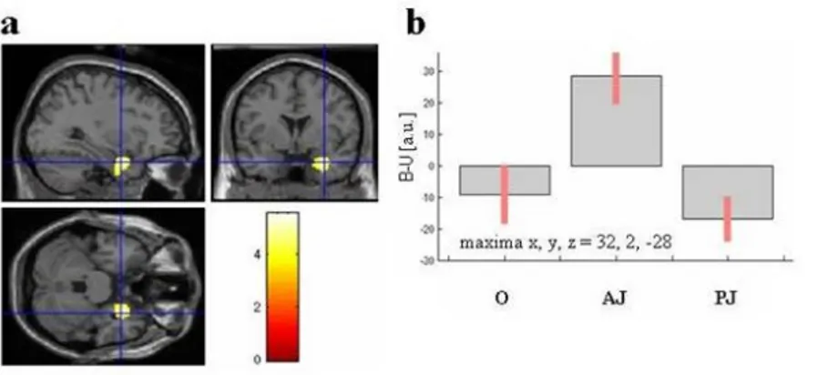 Figure 4. Brain activations in the contrasts “judged-as-beautiful vs.  