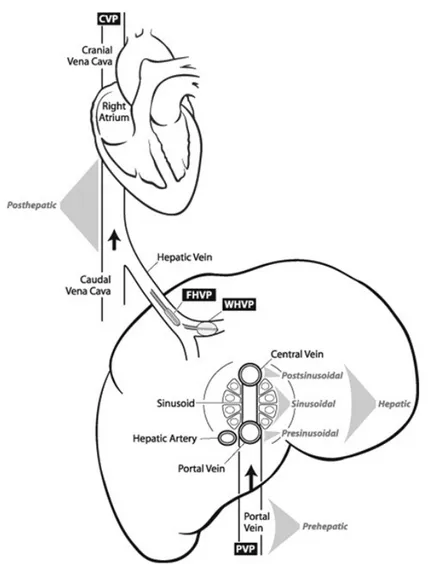 FIG. 2 :Rappresentazione schematica della classificazione anatomica dell’ipertensione portale(9).