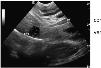 Fig. 8. Cane con shunt 